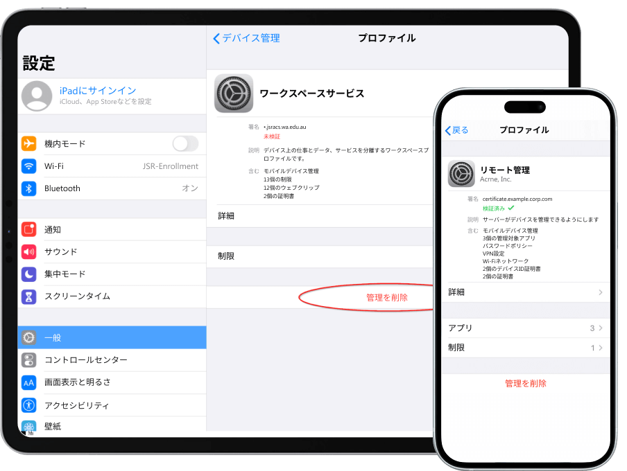 リモート管理を削除する